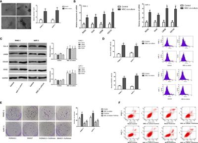 LncRNA SNHG7 Regulates Mesenchymal Stem Cell Through the Notch1/Jagged1/Hes-1 Signaling Pathway and Influences Folfirinox Resistance in Pancreatic Cancer